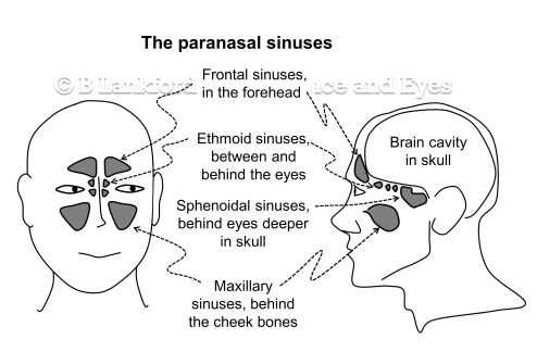 Sinus diagram